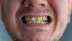 10 reasons your teeth turn yellow and how to prevent them