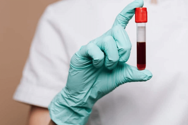 Blood Test For Cancer Detection: This simple blood test can detect many ...