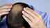 Prevent hair loss with these essential vitamins and minerals