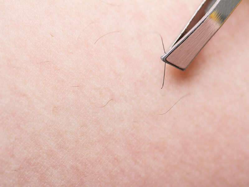 6 Reasons You Should Not Shave Your Pubic Hair The Times Of India